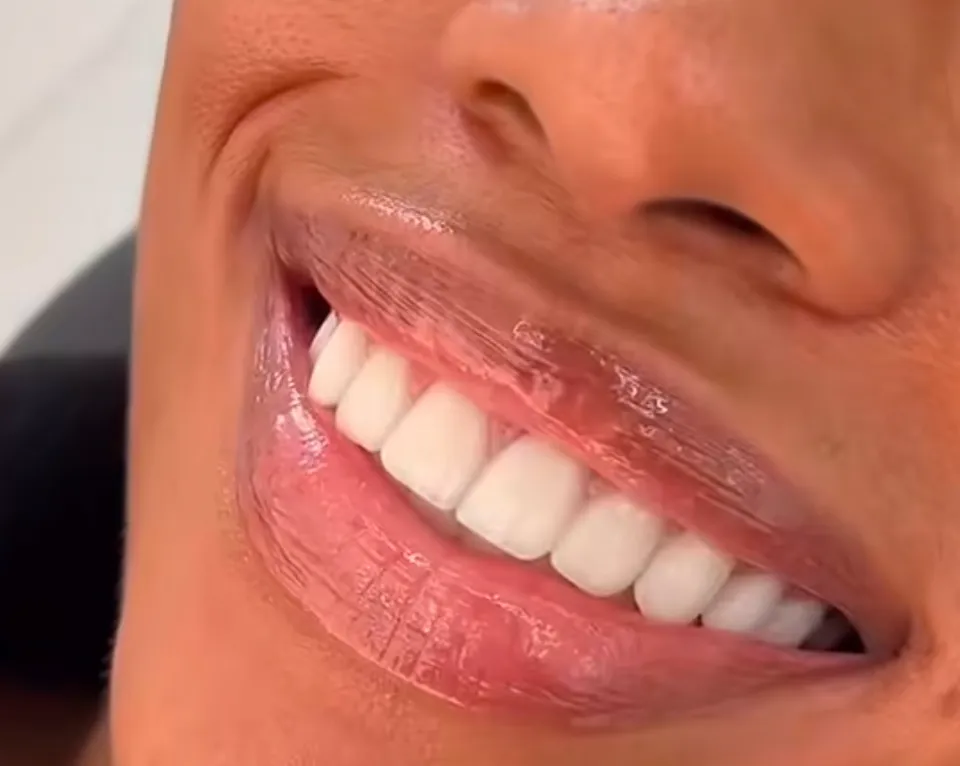 Comprehensive Aesthetic Smile Design Artboard analysis