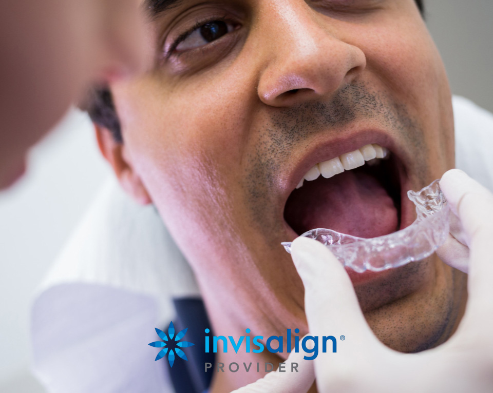 Invisalign clear aligner orthodontics at 80 Harley Street